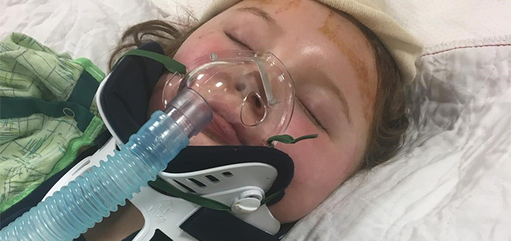 Young girl in a hospital bed with an oxygen tube on her nose and mouth